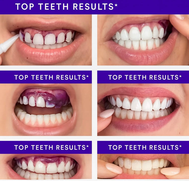 V34 Purple Teeth Whitening Strips, 14 Count, Peroxide-Free, Brightens Teeth in 30 Minutes, Combines Whitening and Colour Correction