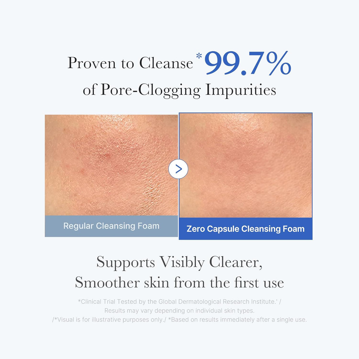 Facial Cleanser Zero Pore Capsule Cleansing Foam