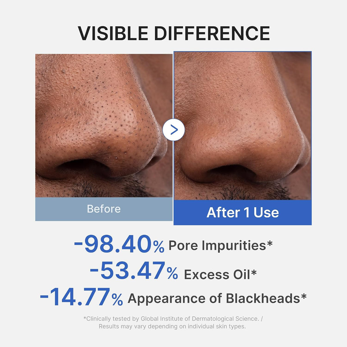 Zero Pore Blackhead Mud Facial Mask - Skin Cooling & Pore Tightening - 3 Minute Quick Dry Formula with AHA, BHA, PHA, and Pore-Purifying Clay - Korean Mud Mask 100G