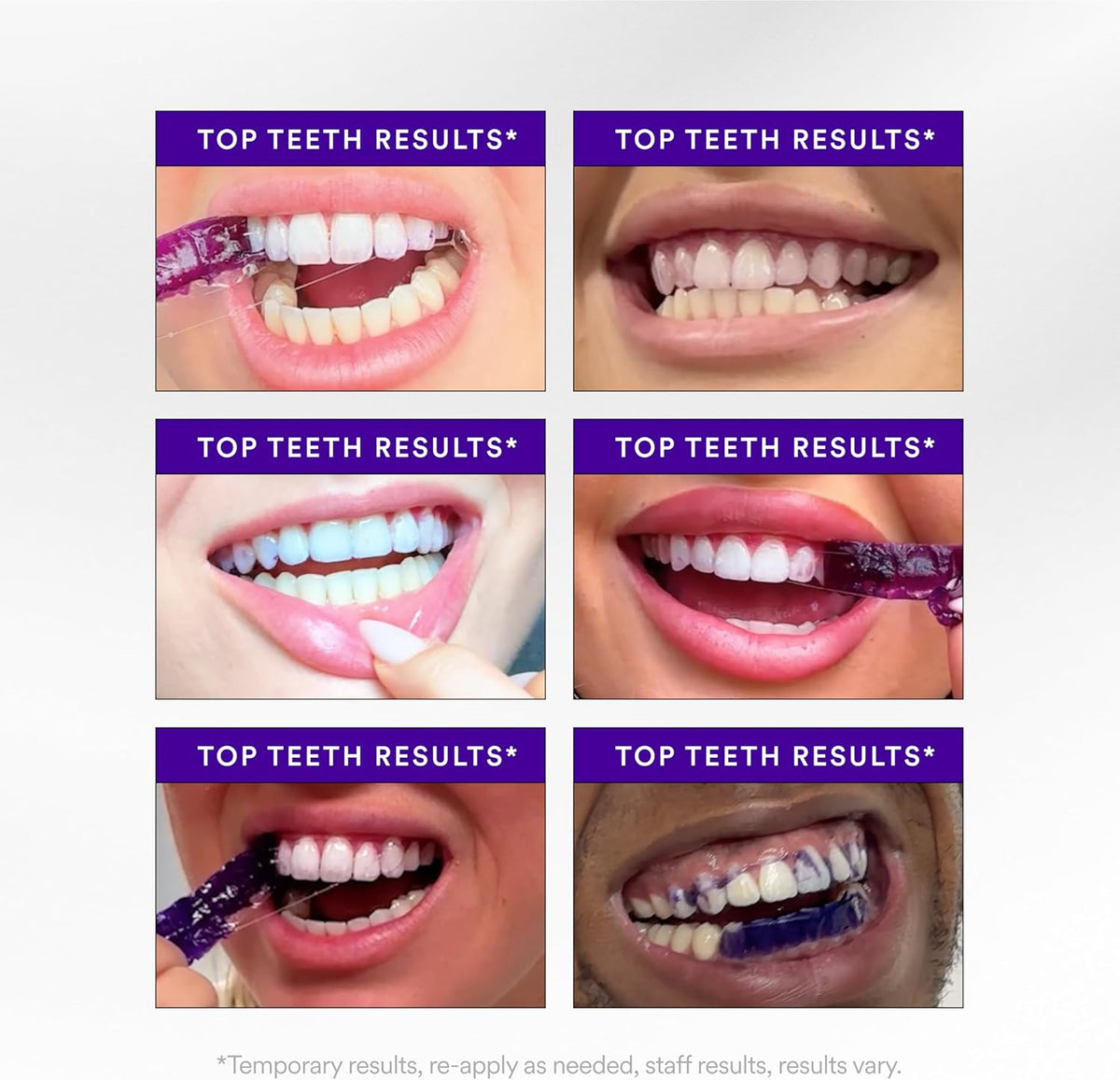 V34 Purple Teeth Whitening Strips, 14 Count, Peroxide-Free, Brightens Teeth in 30 Minutes, Combines Whitening and Colour Correction
