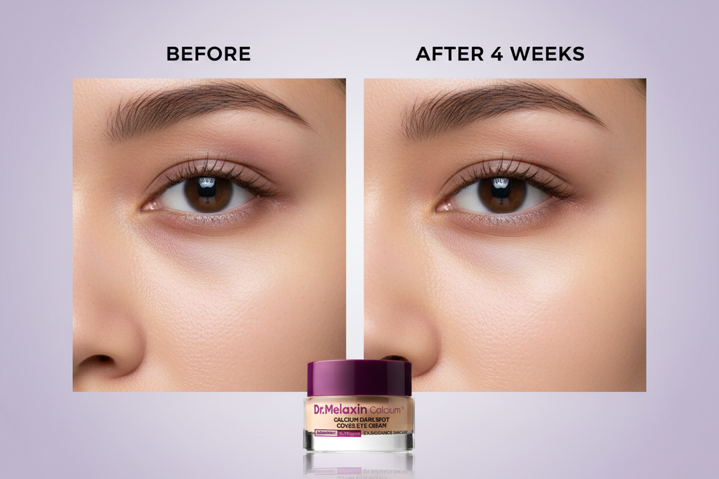 Before and after - dark circles to bright lifted under-eyes