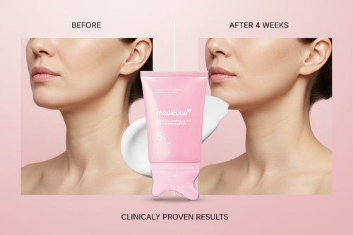 Before and after neck transformation